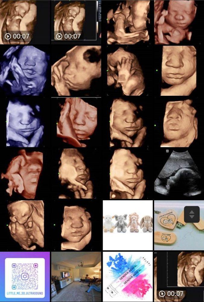Feature image for Little Me 3D Ultrasound - Mobile Service 